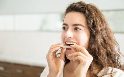 Top 6 Tips for Success with your Aligner Treatment