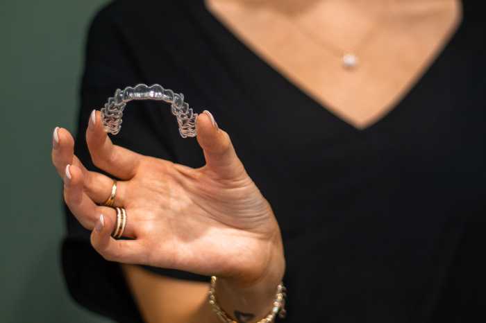 clear aligners