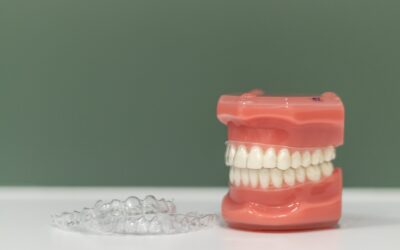 How Retainers Maintain Your New Smile After Aligners