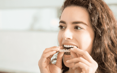 Living with Clear Aligners Made easy