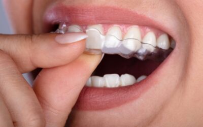 8 Easy Tips for Getting Used to Wearing Clear Aligners
