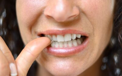 Breaking Bad Habits to Ensure a Healthier Smile