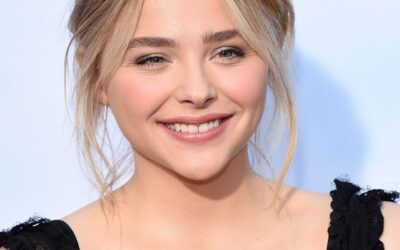 Celebrities Are Choosing Clear Aligners!