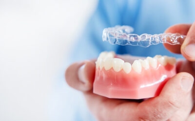 Personalised Treatment Plans for Clear Aligners